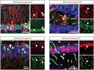 Exploring the dynamics of adult Axin2 cell lineage integration into dentate gyrus granule neurons